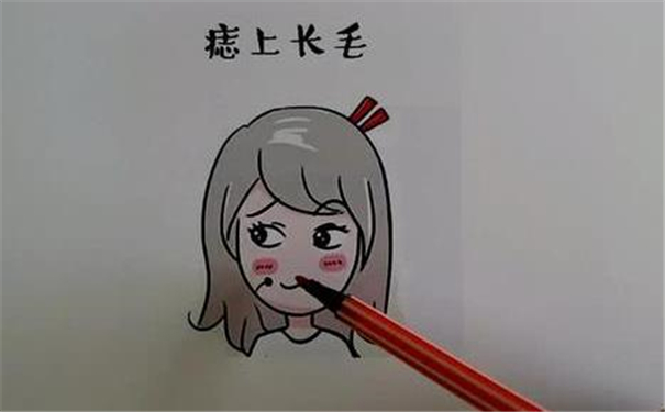 痣上麪長毛