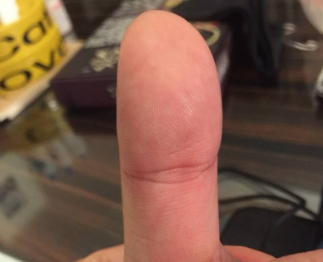 凤眼纹手相图解，拥有的是人生赢家