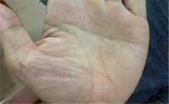 手相岛纹多的人有这些坏处