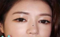 旺夫相的女人痣虽然多，但是这个最常见