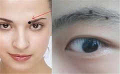 旺夫相的女人痣，这些位置的痣相才是旺夫痣