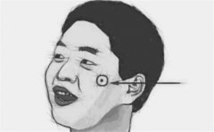 痣的面相图，这种痣相的解读有多方面，好坏参