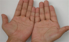 双手断掌纹,断掌纹的运势情况