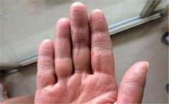 中指很长及其相关中指手相分析,与你想象的有