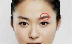 这样的痣是吉痣，位置别搞错了，不然就尴尬了