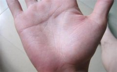 只有两条婚姻线手相分析