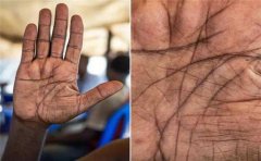 智慧线短很危险 随时会突然死亡