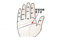 智慧线看健康，有这些情况一定要重视