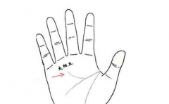 难怪智慧线下垂的人存不住钱,原来是因为这个