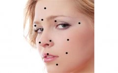 肚脐痣相解读，肚脐长痣运势分析