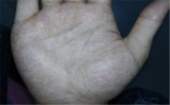 富贵手相有很多，其中这几个最为常见和普遍