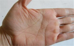 两指箕纹的意义