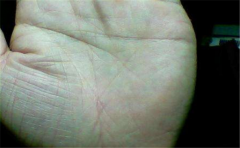 男人纵欲纹清晰且长 再有钱也不能嫁