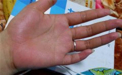 手色泽看健康和性格