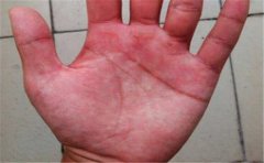 手相图解婚姻线，从最常见的特征分析运势