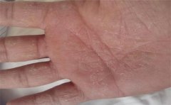 有挣大钱手相的人,上辈子可能是拯救了宇宙,