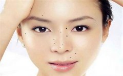 教你怎么看身体上的一些痣相是不是有福气的痣