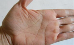 手相指缝宽是典型的漏财手相，会漏财的手相分