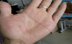 有二婚手相的人很有可能会结两次婚,鲜少有例