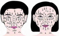 眉间有痣的人不仅事业运差，这些运势同样糟糕