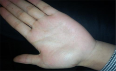 双手通贯手的人有好运，最突出的是事业运和财