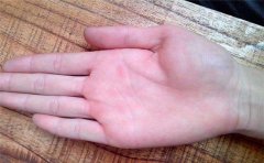 看看天才的手相长什么样