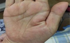 有招小人手相之人易招小人，最好应该这样做