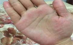 掌心凹陷手相运势分析,基本上都是很好的运势