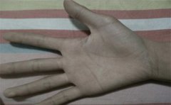 容易离婚女人手相有哪些特征