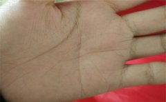 一起来看看破财的手相有哪些