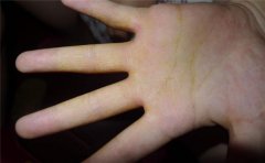 手相看婚姻,看看这些手相的女人婚姻运如何