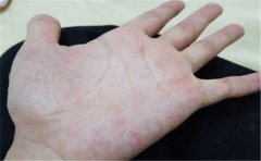 教你怎么看手相桃花劫,不懂的赶紧学习