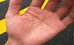 解读女人假断掌手相，它跟真断掌是有区别的