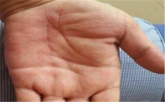 手相看五指也能够看出很多的信息,一起来了解