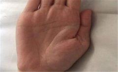 看看你对三条线掌纹了解有多少