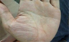 天生自带福气的手相，这些人都是非常好命的