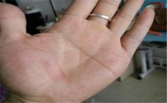 手相分析，丧偶手相都有这些特点