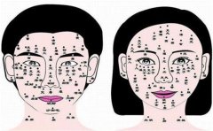 偏财运的痣相分析，这些痣相带来的财运好吗