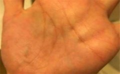 看看婚姻线分叉图解有何寓意，一起了解一下