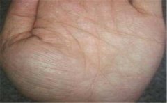 手相只有一条婚姻线的人不多，此手相主要有这