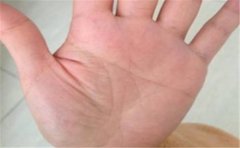 手相太阳丘凹陷寓意不佳，命主还有一大堆坏毛