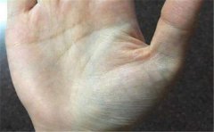 女人指腹掌纹看命运,不知道你是否会看