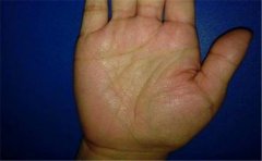 解析生命线出现上升支线的手相,运势都很不错