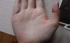 聪明人的手相特征，一般聪明人智慧线都是很长