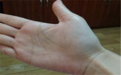 女人双手M字纹不常见，了解特征是关键