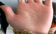 一起来看看易焦虑的手相有何特征，是否比较复