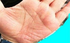 凤眼纹手相总体寓意虽好，也要视具体情况分析