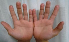 中年以后才爆发的手相，以事业线为例进行分析