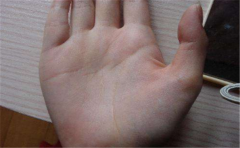 掌纹又轻又乱的人比较敏感，喜欢胡思乱想