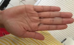 <b>一起来看看女人有什么样的掌纹会离婚</b>